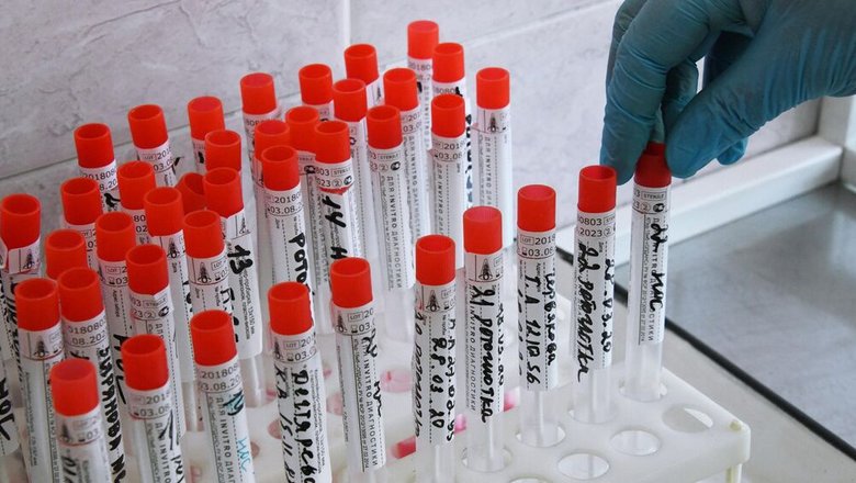 v-rossii-zaregistrirovali-test-na-immunitet-k-holere-e811d53.jpg
